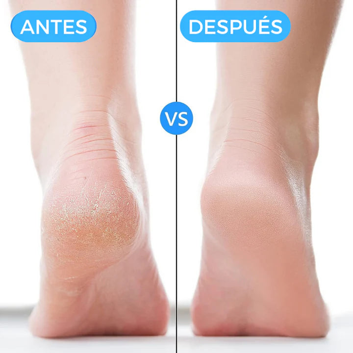 Taloneras Terapéuticas de Silicona (2 unidades)