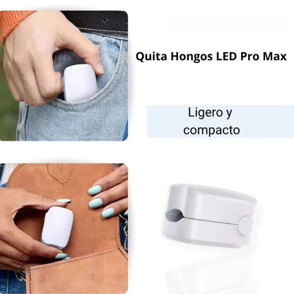 Quita Hongos LED Pro Max - Ataca el hongo profundo sin dolor (7 minutos al día)
