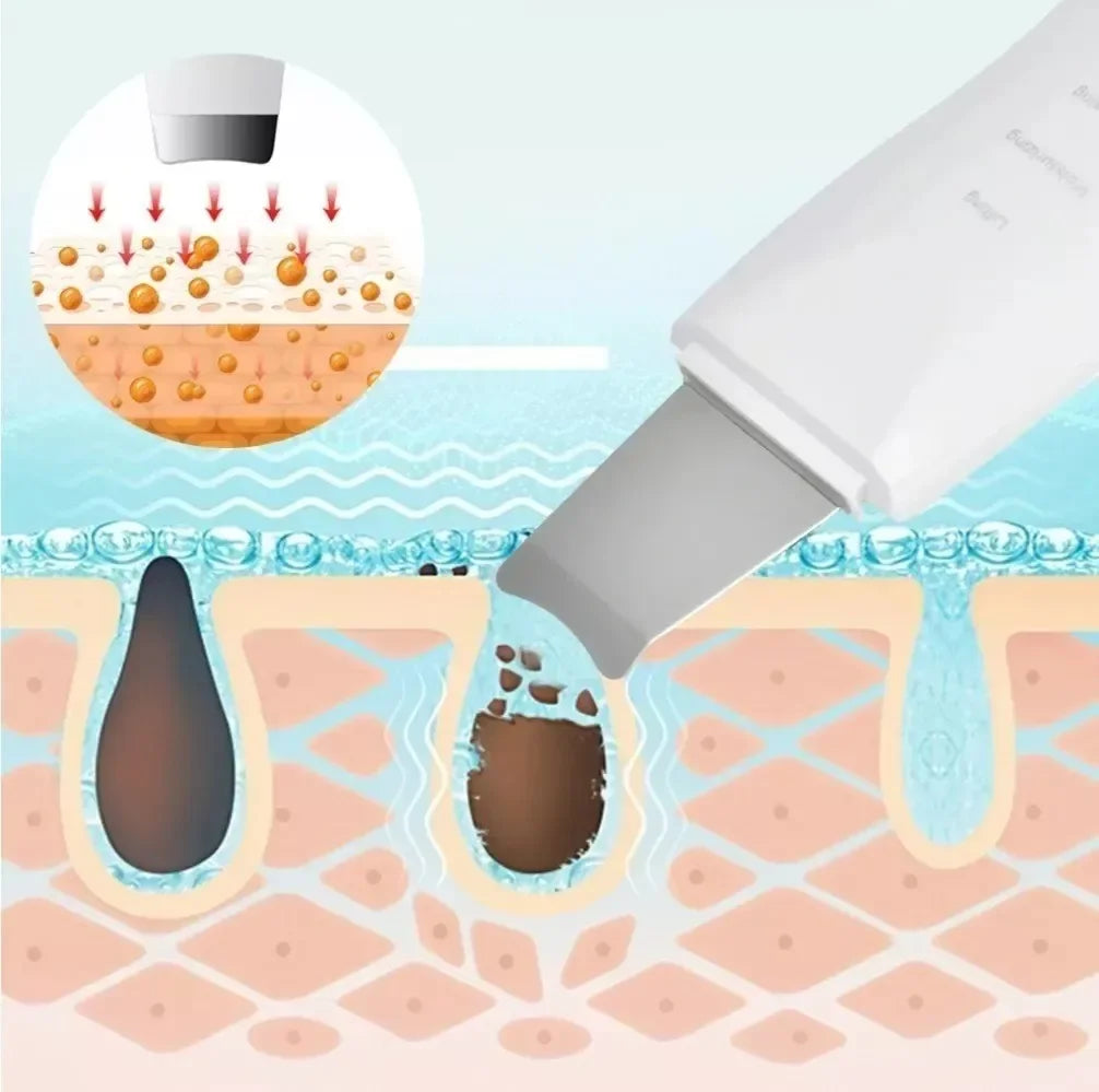 UltraSkin™ - Limpieza ultrasónica profunda y renovación de tu piel